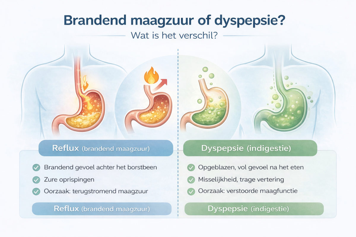 Infographic die het verschil toont tussen brandend maagzuur (reflux) en dyspepsie (indigestie) met symptomen en oorzaken